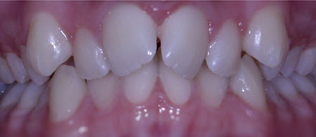 1-ortho