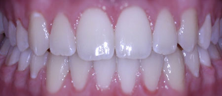 2-ortho
